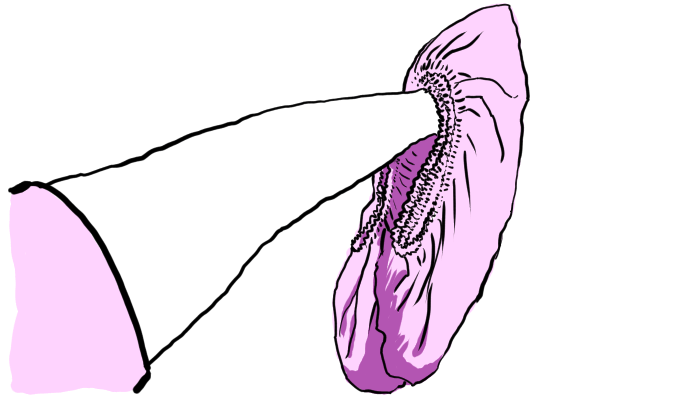 Drawing as described in the text.